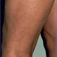 agelesslasercentres