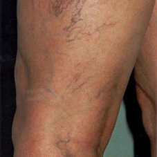 agelesslasercentres