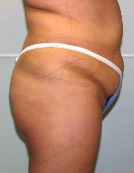 agelesslasercentres