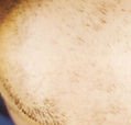 agelesslasercentres
