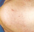agelesslasercentres