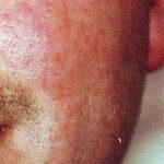 agelesslasercentres
