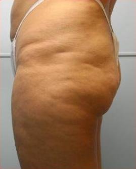 agelesslasercentres