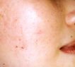 agelesslasercentres