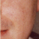 agelesslasercentres