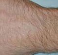 agelesslasercentres