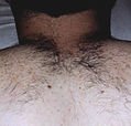 agelesslasercentres