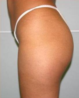 agelesslasercentres