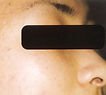 agelesslasercentres