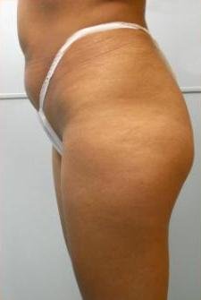 agelesslasercentres