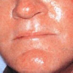agelesslasercentres