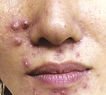 agelesslasercentres