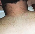agelesslasercentres