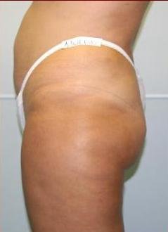 agelesslasercentres