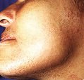 agelesslasercentres