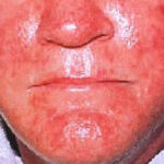 agelesslasercentres