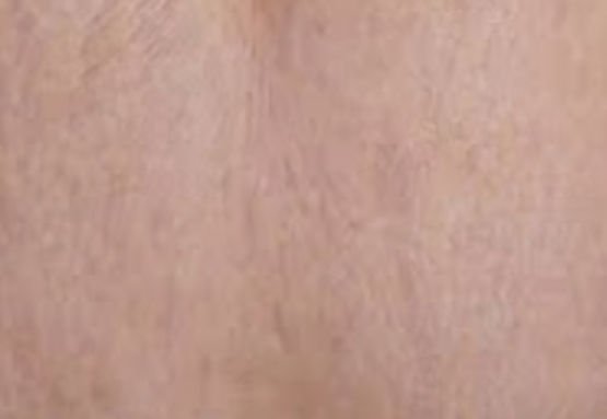agelesslasercentres
