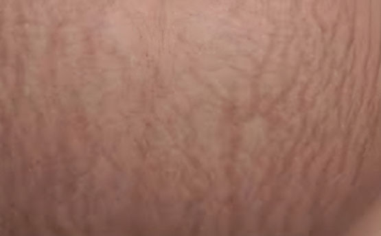 agelesslasercentres