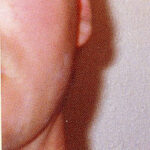 agelesslasercentres