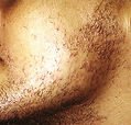 agelesslasercentres