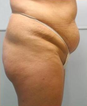 agelesslasercentres