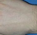 agelesslasercentres