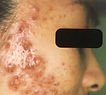 agelesslasercentres