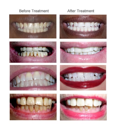 agelesslasercentres