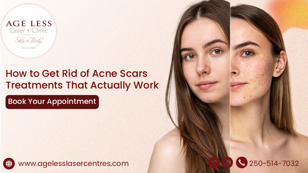 How to Get Rid of Acne Scars: Treatments That Actually Work
